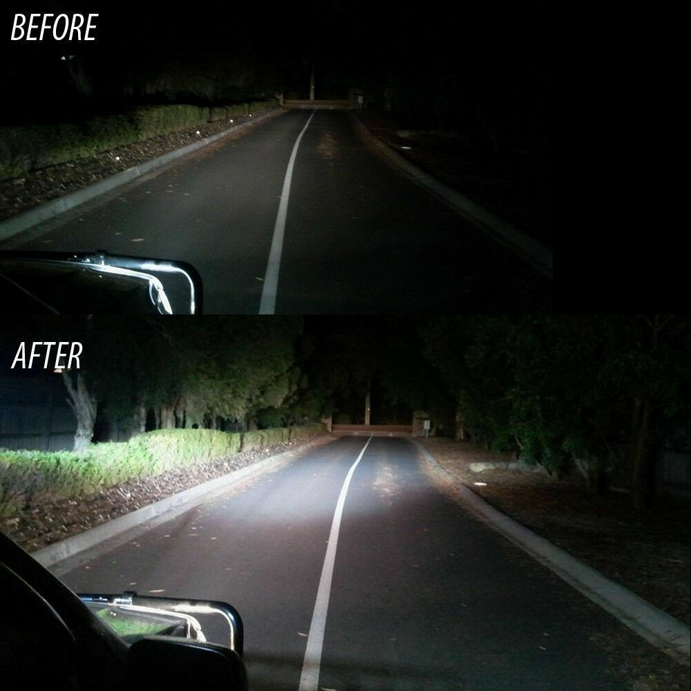 LED Headlights H7+H11 Fog Lights Bulbs Combo Kit For Hyundai Sonata 2011 – 2014